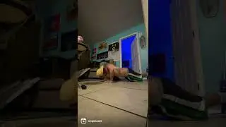 Amputee ampupete