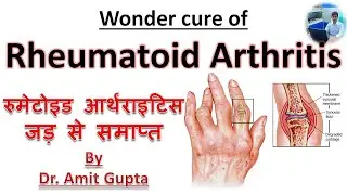 Rheumatoid arthritis cured case |Permanent cure of Rheumatoid arthritis||