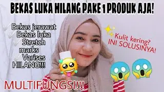 CARA MENGHILANGKAN BEKAS LUKA & BEKAS JERAWAT PAKE 1 PRODUK DOANG😱 | Syntia pitaloka