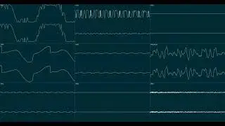 Sega Genesis - Hurts to Wake (Original)