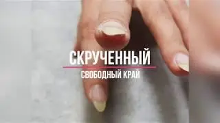 Исправление свободного края