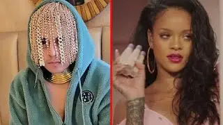 THE 7 STRANGEST AND MOST EXPENSIVE IMPLANTS OF HIP HOP ARTISTS EVER