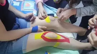 Knee pain and kinesiotaping Technique.