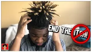 How To Solve Itchy Dreads! | Dreadlocks