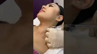 Trying #sunekos for the first time, also my virgin neck #aesthetictreatments