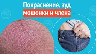 😥 Покраснение, зуд мошонки и члена. Клинический случай №1215