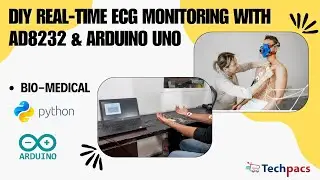 DIY Real-Time ECG Monitoring with AD8232 & Arduino UNO 🛠️💓