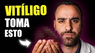 El ELIXIR Que te Ayudara a PIGMENTAR
