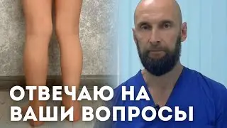 Вальгустная деформация обеих стоп
