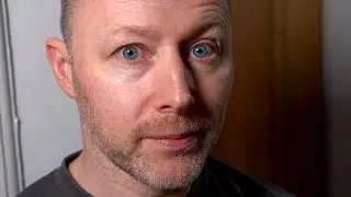 Baldy Three Incher - Limmy's Homemade Show