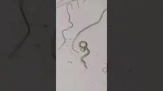 What Are Nematodes?