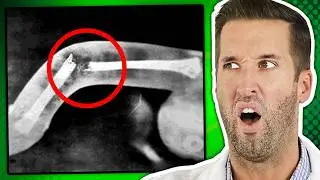 ER Doctor REACTS to Shocking Sex Injuries