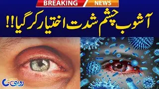 Ashob e Chashm Spread Rapidly In South Punjab l Breaking News l Rohi