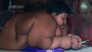 Arya Permana Known As The 'Worlds Heaviest Kid' Has Undergone The Most Amazing Transformation