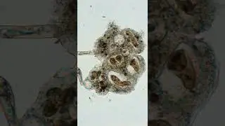 Amoeba has captured several paramecia #shorts