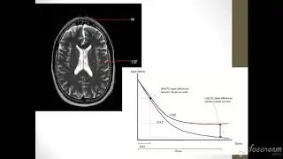 MRI Physics  Part 10 T1 ,T2 and PD اساسيات فيزياء  الرنين المغناظيسي بالعربي