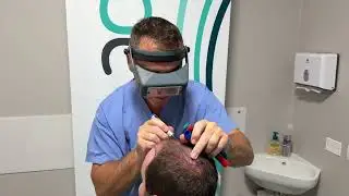 Migliore Clinica Trapianto Capelli Italia 🥇 Capilclinic