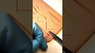 Внутрибольничная инфекция | Тренажер Scalpel med