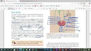 Image Display | Lec 3| Digital Fluoroscopy | General Radiology