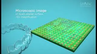 Spark™ Clear Aligners System