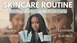 Starting over my skincare routine ft Liz Earle | 10 years of acne chit chat