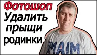 Фотошоп прыщи и родинки удалить | как убрать прыщи родинки на лице в фотошопе