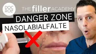 DANGER ZONE💣: NASOLABIALFALTE mit HYALURON – Dr. Rolf Bartsch #beauty #hyaluronicacid