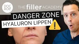 HYALURON LIPPEN RISIKEN – die Danger Zone 💣 erklärt von Dr. Rolf Bartsch