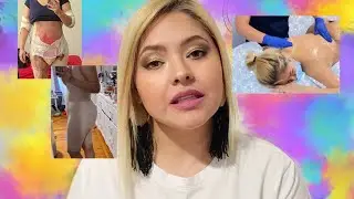 BBL mi viaje a Miami para mi cirugía de lipo transferencia.