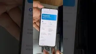 Mi 11X Into Oneplus 12R HyperOS Into OxygenOs 14 Android 14 Alioth