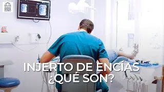 ¿Qué es el injerto de encía y en qué consiste?