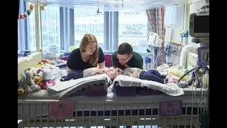 Doctors just separated twin girls joined at the head in one of the world’s rarest surgeries