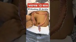 Try this technique for bloating and acidity 