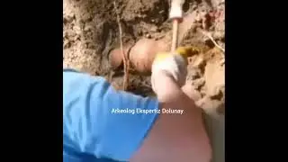 Arkeoloji Çalışması Ameliyata Benzer