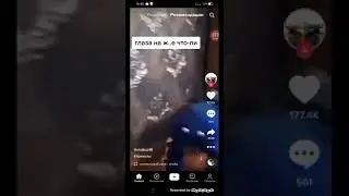 Глаза на попе