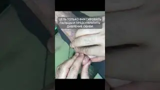 Можно ли помочь снизить боль при деформации пальцев? Да, этому может научиться каждый 👌🏻