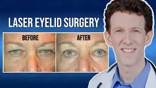 Laser Eyelid Surgery | Sharon's Testimonial