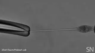 Watch Lacrymaria olor’s neck extend | Science News
