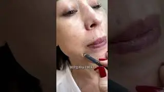Эти волшебные точки🔥которые способны за 1 посещение лишить вас переживаний за своб мимику 😉⠀