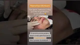 #keşfet #plastikcerrahi #kökhüceyrə #youtubeshorts