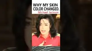 Michael Jackson: Why My Skin Color Changed: #facts