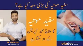 Safed Motia Ka Ilaj - Cataract Symptom Treatment - Safaid Motia Ki Alamat - Safed Motia Kya Hota Hai
