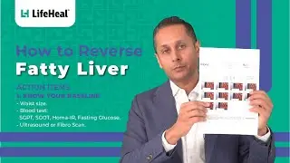 How to Reverse Fatty Liver | Improve Liver Function and Health