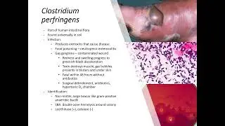 Anaerobic Bacteria