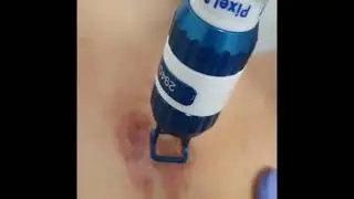 Cicatriz Queloide. Corticoide y Tratamiento Láser. Clínica Merced 👨‍⚕️👩‍⚕️