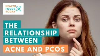 The Relationship Between Acne and PCOS