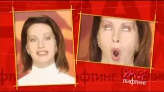 Подтяжка лица:  поднимаем верхнее веко