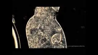 Ciliated Protozoa Heals From Catastrophic Cell Membrane Failure! Darkfield Phase Contrast Combo