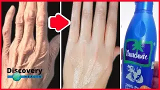 5 Tips that will make your Hands look 10 years younger | Discovery Health