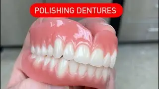 HOW TO POLISH FESTOONED DENTURES. عربي